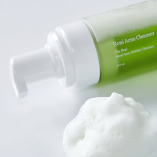 NONI Acne Bubble Cleanser
